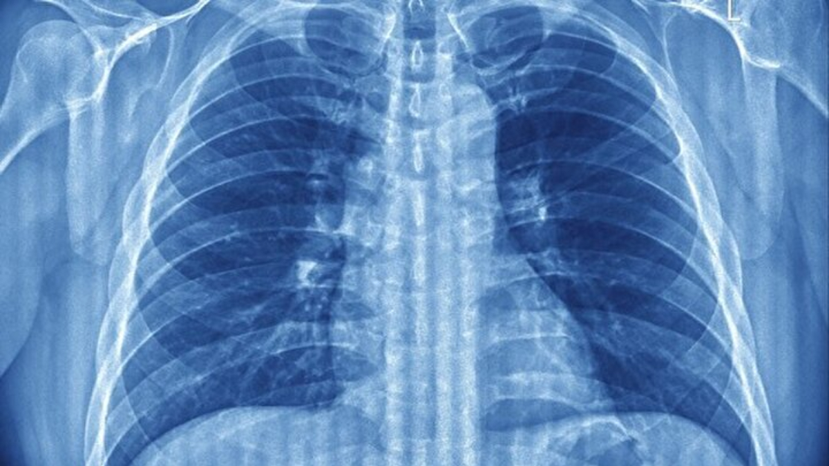 sasiracaksiniz ama ic cekmenin faydasina bakin xSIxK4W1.jpg